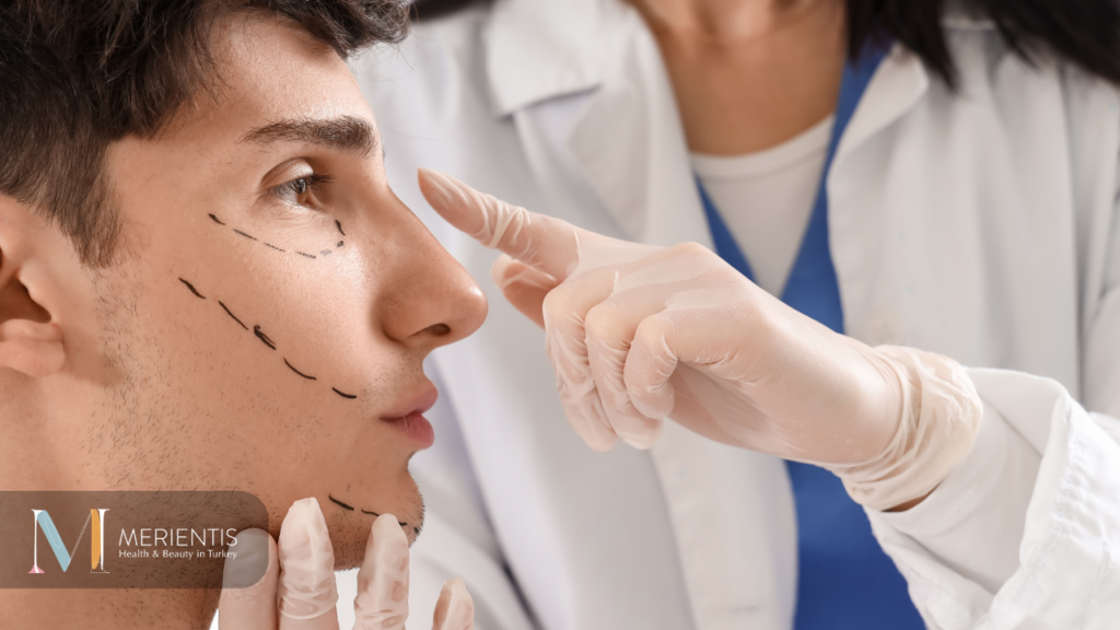 The Red Lines in Rhinoplasty for Men